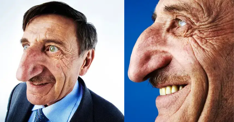 Record holder for longest nose, Mehmet Özyürek, sadly passes away at 75