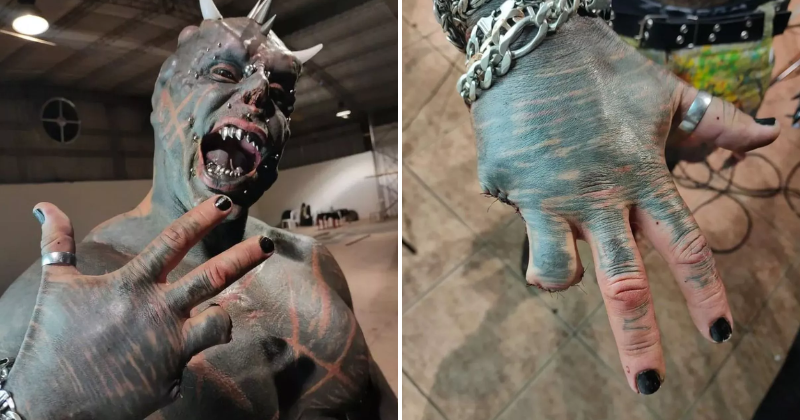 Man Undergoes Extreme Body Modification, Amputates Fingers To Create 'Claw-Like' Hands